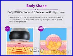 40K Cavitation Ultrasonic Vacuum RF Cellulite Skin Firming Body Reshape Machine