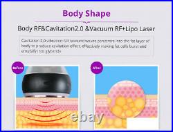40K Cavitation Ultrasound Ultrasonic RF Weight Loss Body Slimming Beauty Machine