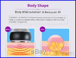 5-1 Ultrasonic Cavitation2.0 RF Radio Frequency Vacuum Body Slim Machine Beauty