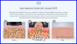 5 in 1 40K Cavitation Ultrasonic Multipolar RF Slimming Vacuum Beauty Machine US