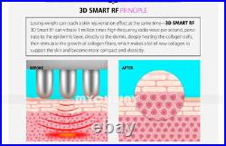 5in1 Vacuum Ultrasonic Cavitation Machine Rf Face Body Slimming Machine Fat Loss