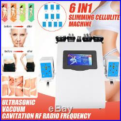 6IN1 40K Ultrasonic Vacuum Cavitation RF Frequency Body Slim Cellulite Machine