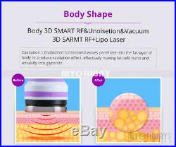 6-1 Ultrasonic Cavitation Slimming Machine Vacuum RF Skin Tightening Anti Weight
