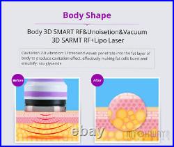 6 IN 1 Ultrasonic Cavitation Vacuum RF Weight Loss Body Slimming Homeuse Machine