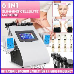 6 in1 110V Vacuum Ultrasonic Cavitation SPA RF Body Slimming Cellulite Machine