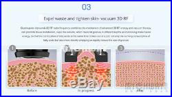 6in1 Lipo Laser Fat Burnt Vacuum Ultrasonic Cavitation RF Body Slimming Machine