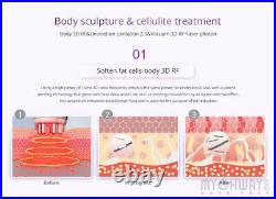 9 In 1 Vacuum Ultrasonic Cavitation 40K RF Body Slimming Cellulite For Home&Spa
