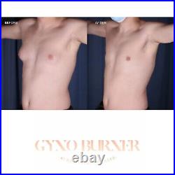AI Ultrasonic Laser Cavitation Gynecomastia Breast Reduction FAT BURNER