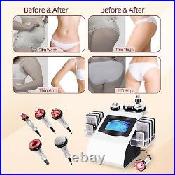 Body Machine Body Multifunctional Beauty Machine Cellulite Device, White