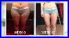 Cavitation_Treatment_Legs_Amazing_Result_Impressed_Cavitation_Radiofrequency_Weightloss_01_qy