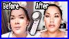 Fat_Cavitation_Before_And_After_01_bdlh