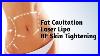 Fat_Cavitation_Laser_Lipo_Rf_Skin_Tightening_01_fuq