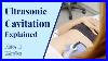 How_Does_Ultrasonic_Cavitation_Work_Body_Treatments_At_Byou_Laser_Clinic_In_Nyc_01_dpsg