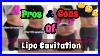 Lipo_Cavitation_Laser_Lipo_Pros_U0026_Cons_Ep_4_01_mo