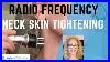 Neck_Radio_Frequency_Treatment_Skin_Tightening_01_bt