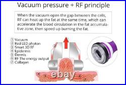 Shape Tactics 5-in-1 40K Cavitation RF Therapy Machine