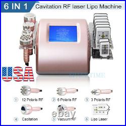 Ultrasonic 40K Cavitation Vacuum RF 6 in 1 Machine Lift Fat Loss Body Sculpting