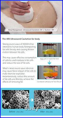 Ultrasonic 40K Vacuum Cavitation RF EMS Electroporation Body Slimming Machine